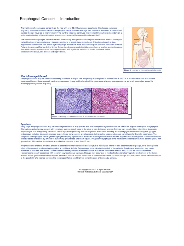 Esophageal Cancer PDF | PDF | Esophageal Cancer | Esophagus