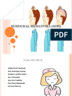 Subdural Hematoma (SDH)