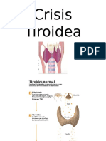 Crisis Tiroidea