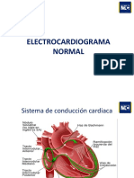 EKG Muestra.pdf