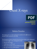 Chest X-Rays: Anusuya R. Radiograher, Department of Radiology, MMCH & Ri