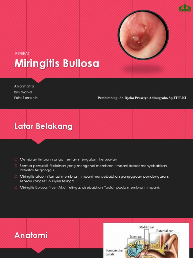 Miringitis Bulosa: Gejala dan Penanganan | PDF