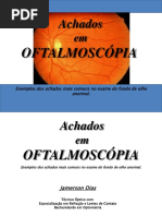 Achados em oftalmoscopia