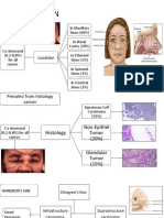 Ca sinonasal cancer locations, histology, survival rates & recurrence factors