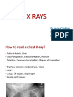 How to Read a Chest X-Ray