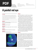 Red Eye Differential Diagnosis Guide | PDF | Cornea | Ophthalmology