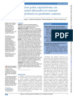 Precision Pulse Capsulotomy: An Automated Alternative To Manual Capsulorhexis in Paediatric Cataract