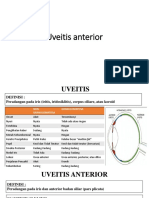 Uveitis Anterior