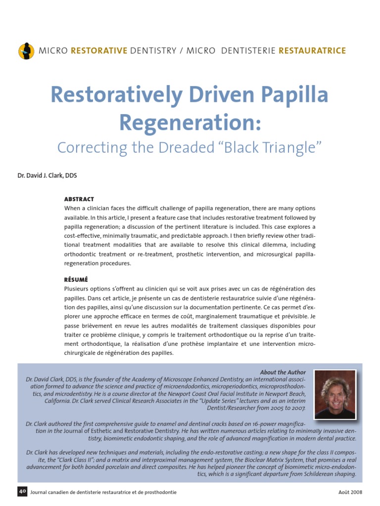 Correcting The Dreaded Black Triangle Gap | PDF | Orthodontics | Dentistry