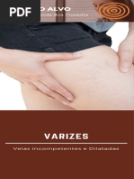 Varizes - Dr. Alexandre Amato