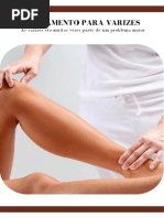 Tratamento Para Varizes - Dr. Alexandre Amato (1)