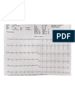 EKG