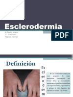 Esclerodermia Fatima