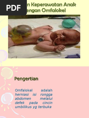 Askep Omfalokel Pada Bayi Sb 2015