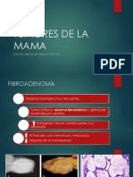 Cancer de Mama