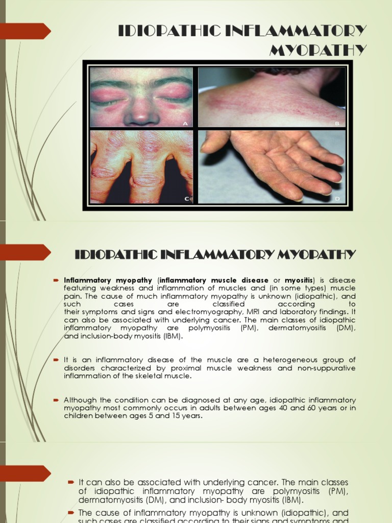 Understanding Idiopathic Inflammatory Myopathy | PDF | Clinical ...