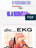 EKG