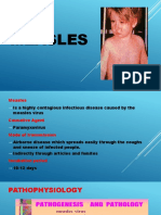 Measles Report