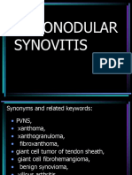 Pilonodular Synovitis 2