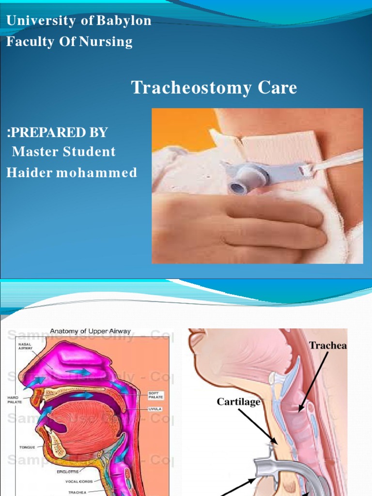 Tracheostomy Care Guidelines and Management | PDF | Respiratory Tract ...