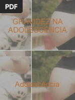 Gravidez na adolescência