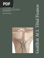 Acl Tightrope Attachable Button System | PDF | Musculoskeletal System ...