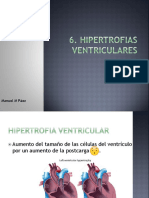 6. Hipertrofia Ventricular