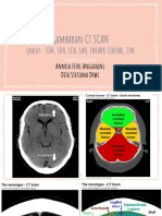 Gambaran CT SCAN: (Kasus: Edh, SDH, Ich, Sah, Infark Cerebri, Ivh