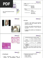 Distrbios cos - EDEMA