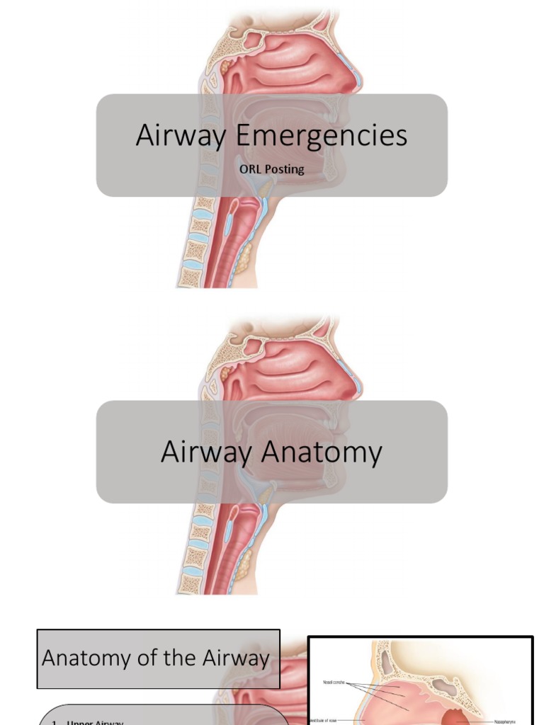 Airway Emergencies: Causes & Management | PDF | Larynx | Human Anatomy