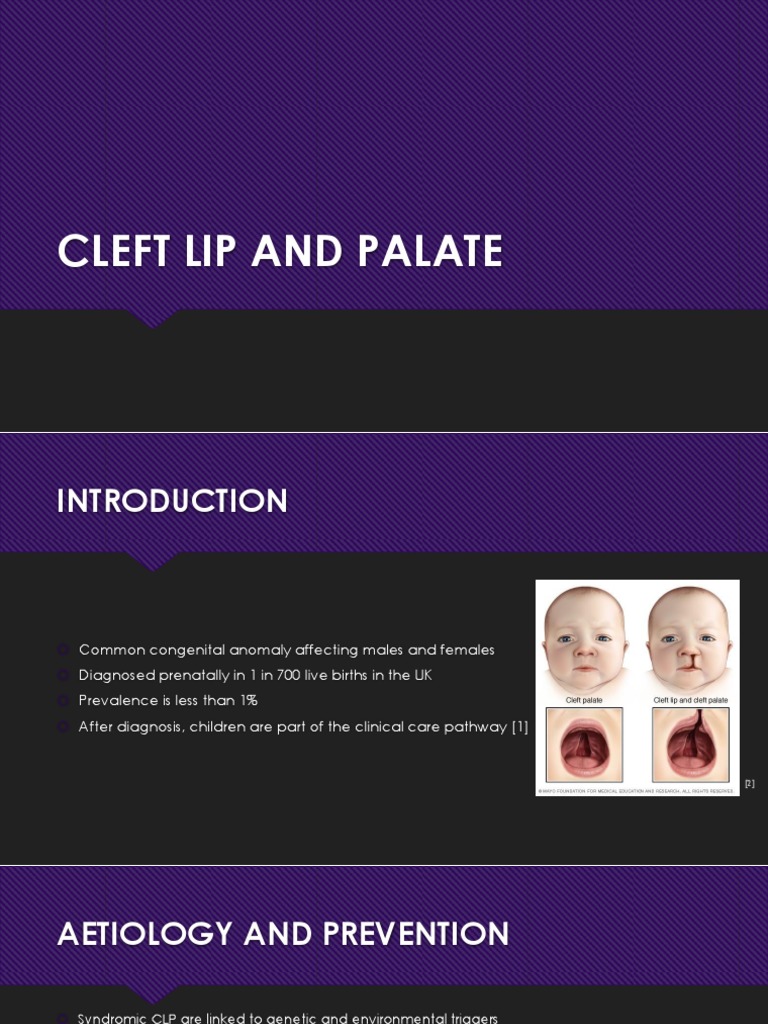 Cleft Lip and Palate PDF Orthodontics Dentistry