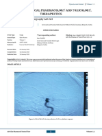 Digital Substraction Angiography Left ACI