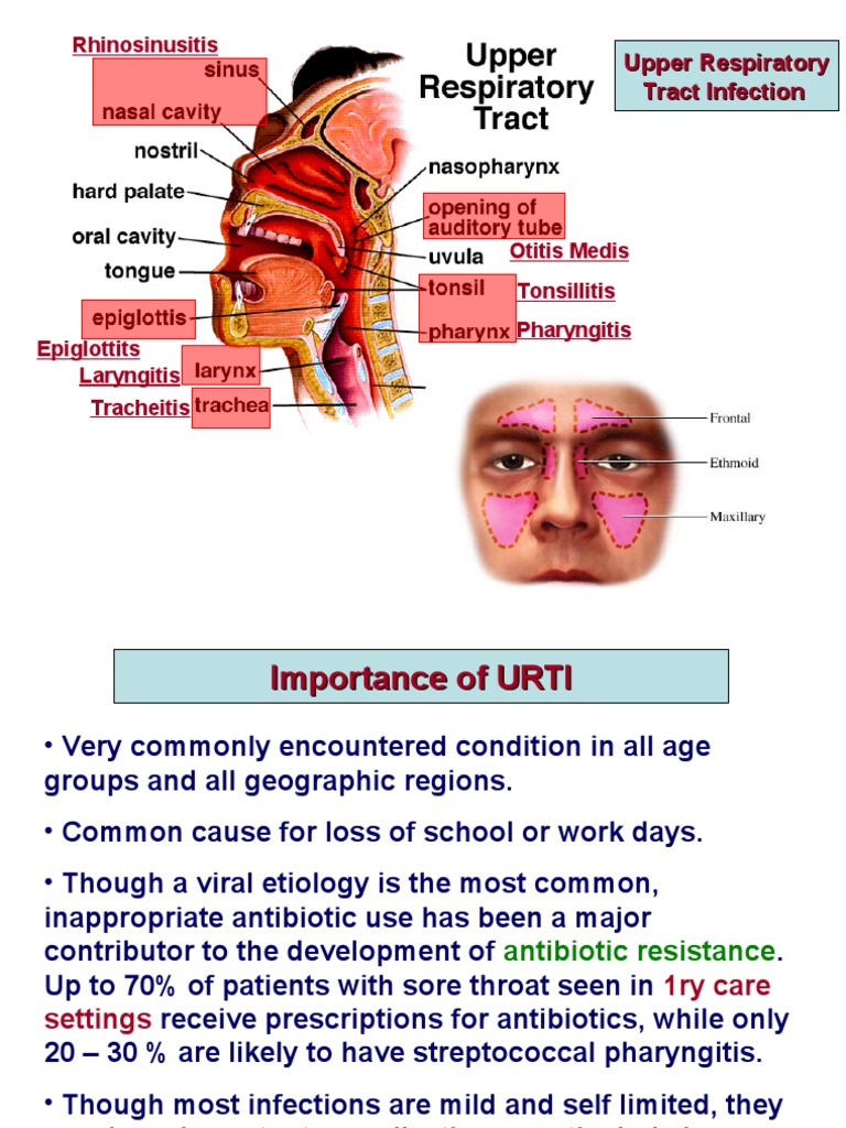 Upper Respiratory Tract Infection PDF Medicine Clinical Medicine