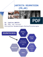 (Poli) Artrita Reumatoida (PR, AR) : Dr. Codrina ANCUTA