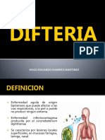 Difteria: Enfermedad bacteriana aguda