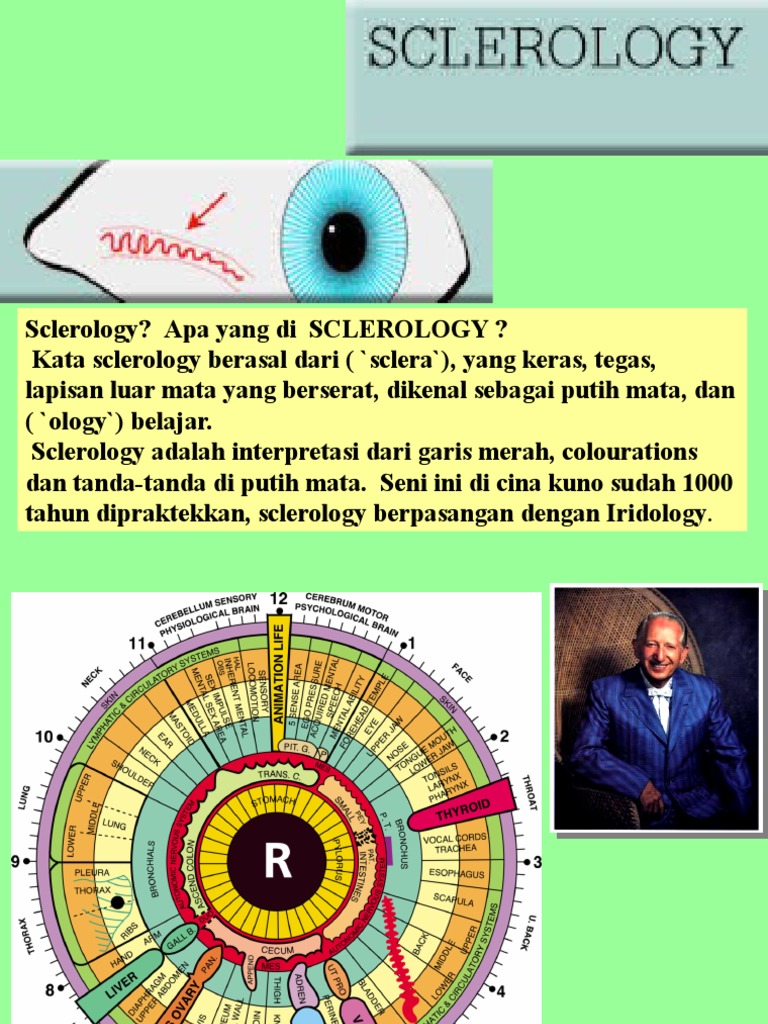 Understanding Sclerology Charts | PDF | Sensory Organs | Ophthalmology