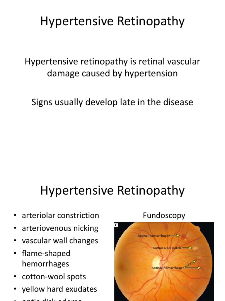 Retina | PDF | Blood Vessel | Hypertension