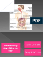 Ibd