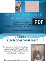 Interpretacion de Ekg