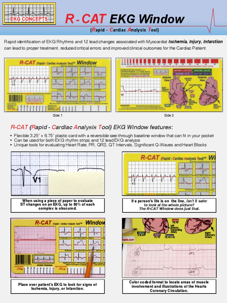 RCAT Window | Download Free PDF | Electrocardiography | Heart