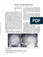 Fat-Fluid Level in Intracranial Epidermoid Cyst: Discussion