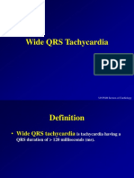 Basic Medical Wide QRS Arrhythmia