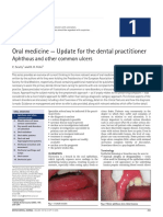 Oral Medicine - Update For The Dental Practitioner: Aphthous and Other Common Ulcers