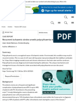 Recurrent Ischaemic Stroke Unveils Polycythaemia Vera - BMJ Case Reports