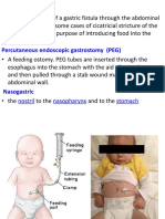 3 Gastrointestinal Intubations