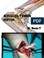 Achilles Tendon Ruptur