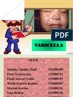 Varicella