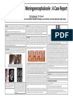 Fronto-Ethmoidal Meningoencephalocele PDF