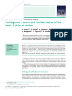 Cartilaginous Tumours and Calcified Lesions of The Hand: A Pictorial Review