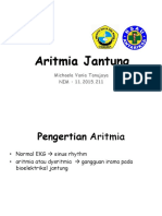 Aritmia Jantung 1
